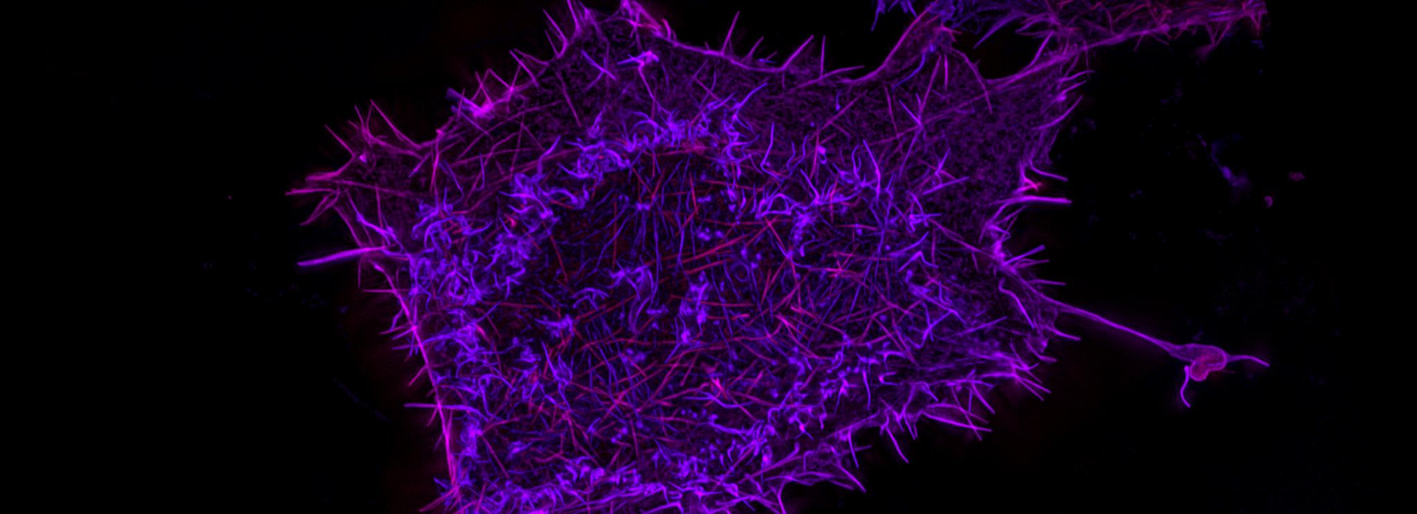 mNeongreenactin